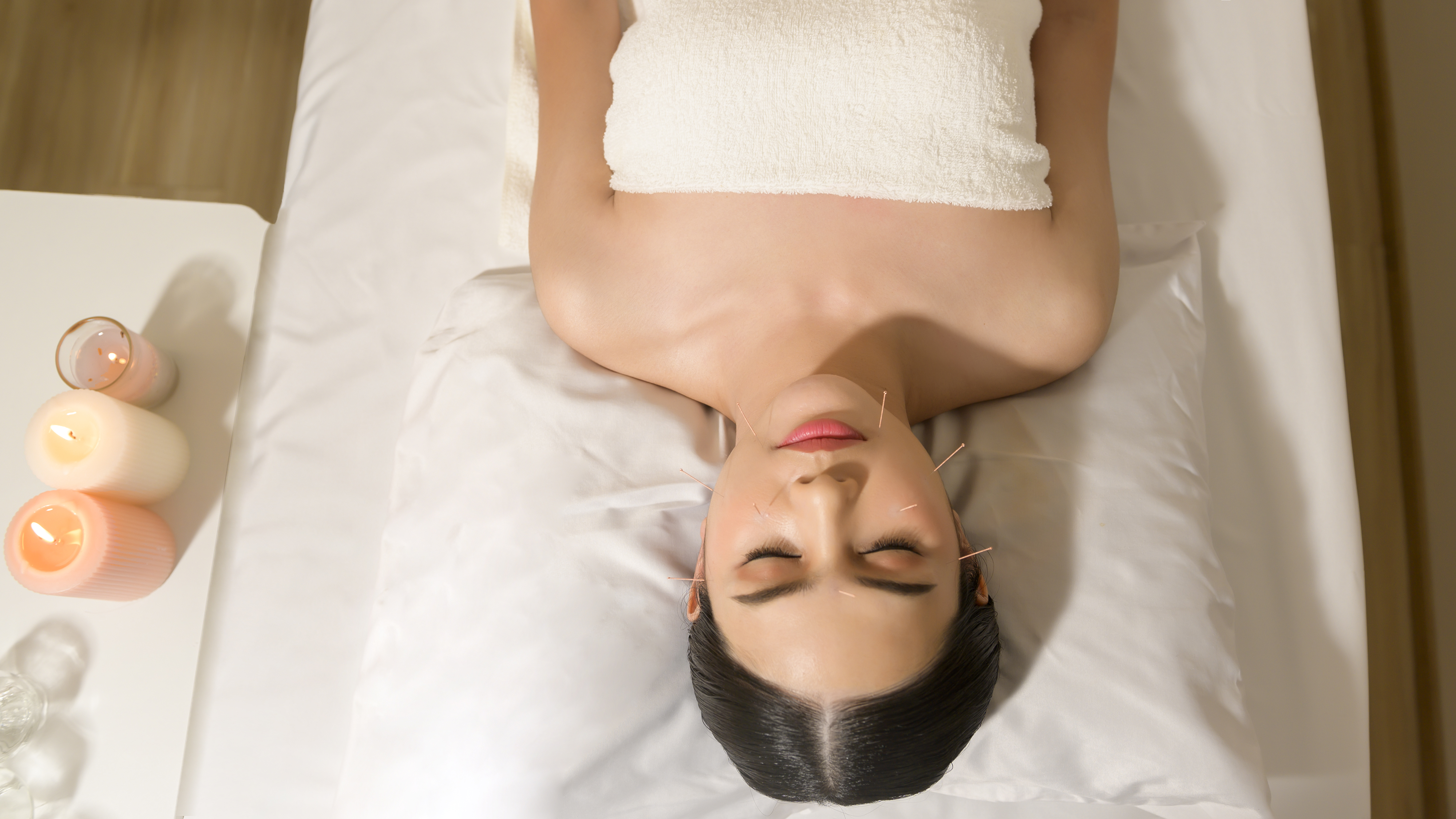 Acupuncture Treatment